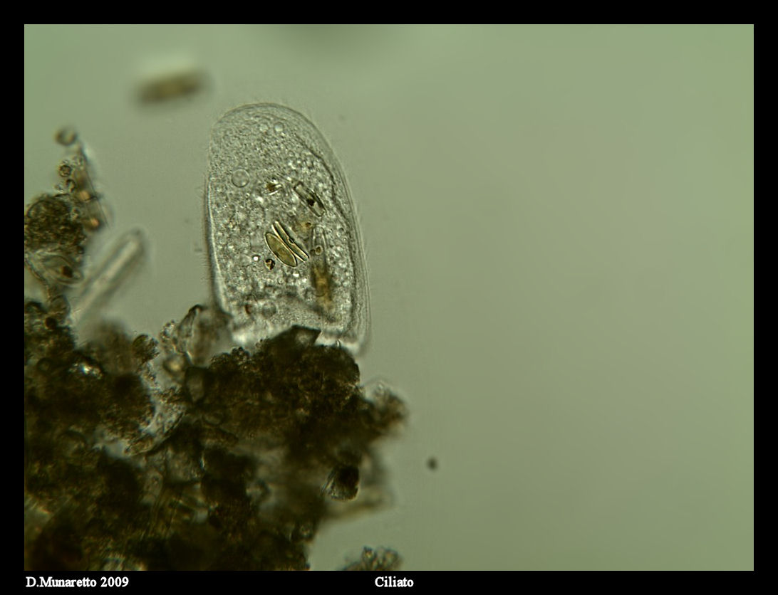 Ciliato con diatomee  [ Chilodonella sp.]